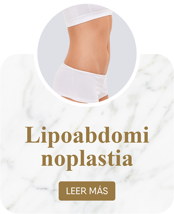 Lipoabdominoplastia